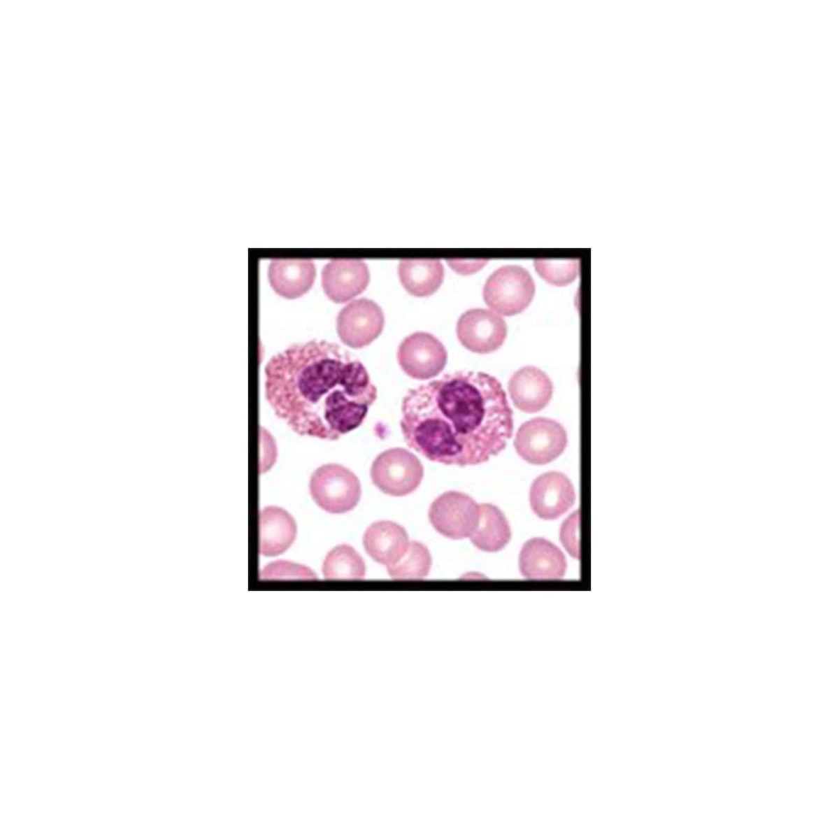 Eosinophil Stain (Hansel), 4oz.